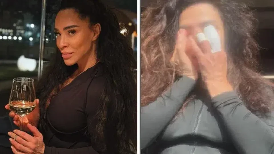 Ужас! Маги Сидерова пострада жестоко от питбула си (Ампутираха пръста й)